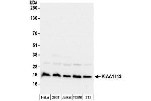 anti-KIAA1143 (KIAA1143) (AA 104-154) antibody