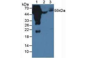 Western blot analysis of (1) Human Serum, (2) Porcine Serum and (3) Mouse Serum. (Kaninchen anti-Human IgG4 (AA 222-327) Antikörper)