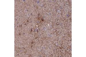 Immunohistochemical staining of human hippocampus with USP37 polyclonal antibody  shows distinct cytoplasmic positivity in astrocytes at 1:10-1:20 dilution.