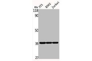 Western Blot analysis of NIH-3T3 K562 Jurkat cells using ERdj3 Polyclonal Antibody (DNAJB11 Antikörper  (Internal Region))