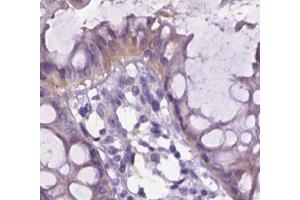 Immunohistochemical analysis of paraffin-embedded Human colon tissue labeling Integrin beta 7