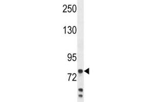 Anti-Myeloperoxidase antibody western blot analysis in MDA-MB231 lysate. (Myeloperoxidase Antikörper  (AA 420-448))