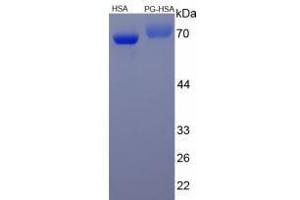 Image no. 2 for Progesterone peptide (HSA) (ABIN5666020)