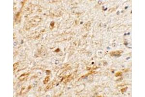 Immunohistochemistry of TMEM106A in mouse brain tissue with TMEM106A Antibody at 5 µg/ml. (TMEM106A Antikörper  (N-Term))