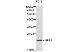 Western Blotting (WB) image for anti-Natriuretic Peptide A (NPPA) antibody (ABIN1873936) (NPPA Antikörper)
