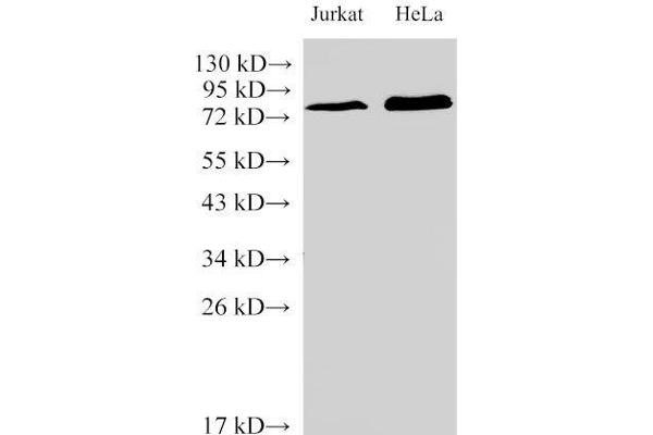 IL-6 Receptor Antikörper