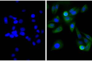 Human pancreatic carcinoma cell line MIA PaCa-2 was stained with Mouse Anti-Cytokeratin 18-UNLB, and DAPI.