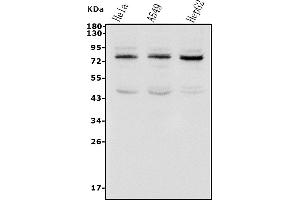 Western blot analysis of TAB2 using anti-TAB2 antibody (ABIN7600244).