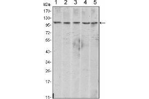 Western blot analysis using CDH2 mouse mAb against A431 (1), NIH/3T3 (2), Hela (3), C6 (4) and LNCap (5) cell lysate.