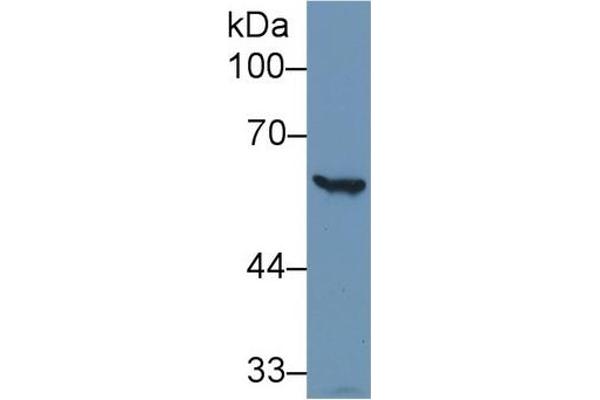 Glucose-6-Phosphate Dehydrogenase Antikörper