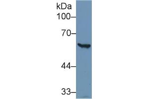 Detection of G6PD in Human Hela cell lysate using Polyclonal Antibody to Glucose-6-phosphate Dehydrogenase (G6PD) (Glucose-6-Phosphate Dehydrogenase Antikörper)
