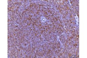 IHC analysis of Ccl3 using anti-Ccl3 antibody (ABIN7600860). (CCL3 Antikörper  (AA 24-92))