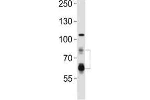 Western blot analysis of lysate from HeLa cell line using PCSK9 antibody. (PCSK9 Antikörper  (AA 144-173))