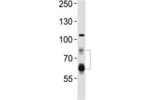Western blot analysis of lysate from HeLa cell line using PCSK9 antibody.