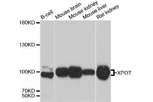 Western blot analysis of extracts of various cell lines, using XPOT antibody (ABIN6292909) at 1:3000 dilution.