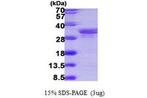 SDS-PAGE (SDS) image for SGT1, Suppressor of G2 Allele of SKP1 (SUGT1) (AA 115-365) protein (His tag) (ABIN667341)