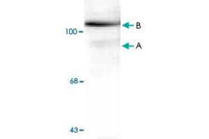 Western blot of whole cell T-47D lysate prepared from cells that had been incubated in the presence of the synthetic progestin agonist R5020 (500 nM) showing specific immunolabeling of the ~90k PGR-A isoform and the ~120 PGR-B isoform of the PGR phosphorylated at Ser294.