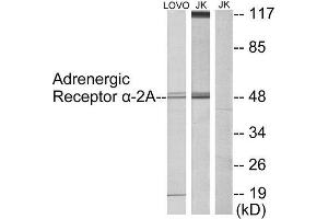 Western Blotting (WB) image for anti-Alpha-2A Adrenergic Receptor (ADRA2A) (C-Term) antibody (ABIN1849124) (ADRA2A Antikörper  (C-Term))