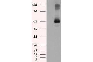 HEK293T cells were transfected with the pCMV6-ENTRY control (Left lane) or pCMV6-ENTRY LIPG (Right lane) cDNA for 48 hrs and lysed. (LIPG Antikörper)