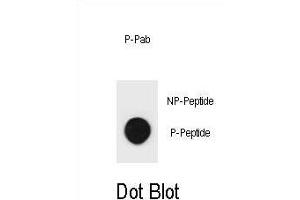 Dot blot analysis of mouse TSC2 Antibody (Phospho ) Phospho-specific Pab (ABIN1881941 and ABIN2839937) on nitrocellulose membrane. (Tuberin Antikörper  (pSer1412))