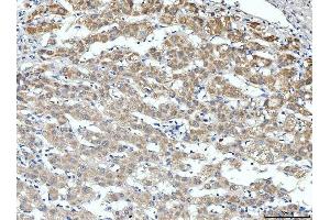 IHC analysis of ALDH3A1 using anti-ALDH3A1 antibody (ABIN7601680). (ALDH3A1 Antikörper  (AA 413-453))