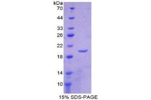 SDS-PAGE (SDS) image for Lipocalin 1 (LCN1) (AA 24-172) protein (His tag) (ABIN2125701) (Lipocalin 1 Protein (LCN1) (AA 24-172) (His tag))