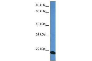 Western Blot showing COMMD1 antibody used at a concentration of 1 ug/ml against Fetal Heart Lysate (COMMD1 Antikörper  (C-Term))
