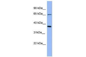 Uromodulin antibody used at 1 ug/ml to detect target protein. (Uromodulin Antikörper  (Middle Region))
