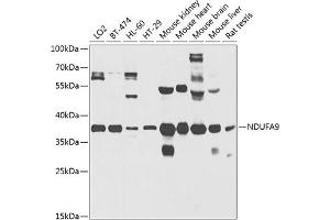 Western blot analysis of extracts of various cell lines, using NDUF antibody (ABIN3017566, ABIN3017567, ABIN5664241 and ABIN6220158) at 1:1000 dilution. (NDUFA9 Antikörper  (AA 1-270))