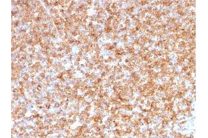 Formalin-fixed, paraffin-embedded human Tonsil stained with HLA- Pan Mouse Monoclonal Antibody (CR3/43). (MHC Class II HLA-DP/DQ/DR Antikörper)