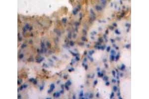 IHC-P analysis of Lung tissue, with DAB staining. (SEMA3E Antikörper  (AA 581-669))