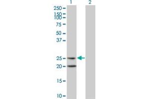 Western Blot analysis of IL6 expression in transfected 293T cell line by IL6 monoclonal antibody (M06), clone 4H5. (IL-6 Antikörper  (AA 29-212))