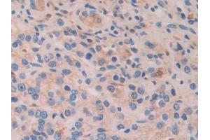 Immunohistochemistry (IHC) image for anti-Activating Transcription Factor 4 (Tax-Responsive Enhancer Element B67) (ATF4) (AA 130-347) antibody (ABIN7433582)