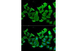 Immunofluorescence analysis of A549 cells using HAGH antibody (ABIN5973978). (HAGH Antikörper)