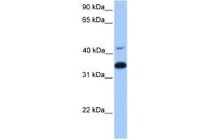 GNB2 antibody used at 1 ug/ml to detect target protein. (GNB2 Antikörper)