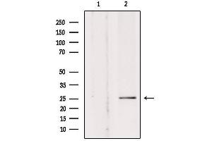 Western blot analysis of extracts from rat brain, using SOD-3  Antibody. (SOD3 Antikörper  (Internal Region))