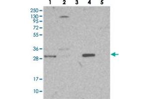 Western blot analysis of Lane 1: RT-4, Lane 2: U-251 MG, Lane 3: Human Plasma, Lane 4: Liver, Lane 5: Tonsil with NIT2 polyclonal antibody  at 1:250-1:500 dilution.