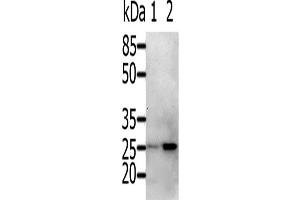Western Blotting (WB) image for anti-RAB5A, Member RAS Oncogene Family (RAB5A) antibody (ABIN2425528) (RAB5 Antikörper)