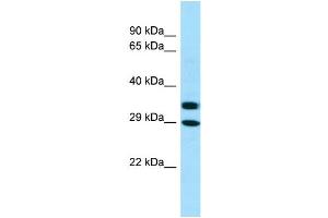WB Suggested Anti-AKR1A1 Antibody Titration: 1. (AKR1A1 Antikörper  (C-Term))