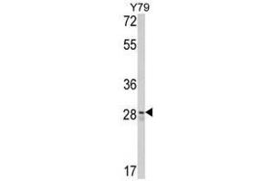 Image no. 1 for anti-CUE Domain Containing 2 (CUEDC2) (C-Term) antibody (ABIN452895) (CUEDC2 Antikörper  (C-Term))