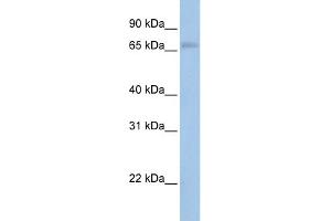 WB Suggested Anti-MAP3K2 Antibody Titration:  0. (MAP3K2 Antikörper  (N-Term))