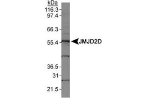 Western blot analysis of JMJD2D in HeLa nuclear extracts using JMJD2D polyclonal antibody . (JMJD2D Antikörper  (AA 460-520))