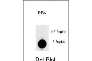 Dot blot analysis of anti-Phospho-LIN28- Phospho-specific Pab (ABIN650868 and ABIN2839816) on nitrocellulose membrane. (LIN28A Antikörper  (pSer134))