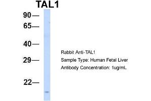 Host: Rabbit Target Name: TAL1 Sample Type: Human Fetal Liver Antibody Dilution: 1. (TAL1 Antikörper  (N-Term))