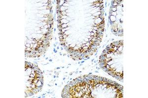 Immunohistochemistry of paraffin-embedded human colon using CCL2 antibody at dilution of 1:100 (40x lens).