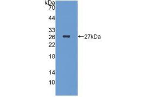 Figure. (ICA1 Antikörper  (AA 1-258))