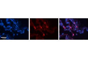 Rabbit Anti-HLA-F Antibody     Formalin Fixed Paraffin Embedded Tissue: Human Lung Tissue  Observed Staining: Membrane and cytoplasmic in alveolar type I cells  Primary Antibody Concentration: 1:100  Secondary Antibody: Donkey anti-Rabbit-Cy3  Secondary Antibody Concentration: 1:200  Magnification: 20X  Exposure Time: 0. (HLA-F Antikörper  (N-Term))