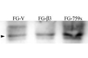 FG Pancreatic Carcinoma Cell stably expressing vector along (FG-V) the b3 integrin subunit (FG-b3) or a b3 truncation mutant (FG-759x). (Src Antikörper  (pTyr215))