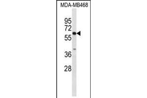 Western blot analysis of CES7 Antibody in MDA-MB468 cell line lysates (35ug/lane) (CES5A Antikörper  (AA 244-270))
