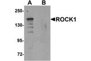 Western blot analysis of ROCK1 in 293 cell lysate with ROCK1 antibody at 1 μg/ml in (A) the absence and (B) the presence of blocking peptide. (ROCK1 Antikörper  (N-Term))